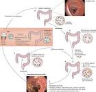 fecal microbiota transplantation