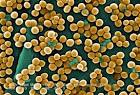 Methicillin-resistant Staphylococcus aureus (MRSA)